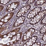 Merck Anti-TGFA antibody produced in rabbit