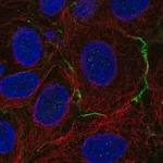 Merck Anti-CELSR1 antibody produced in rabbit