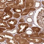 Merck Anti-ATAT1 antibody produced in rabbit