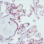 Merck Anti-Cytokeratin, pan antibody, Mouse monoclonal