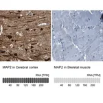 Merck Anti-MAP2 antibody produced in rabbit