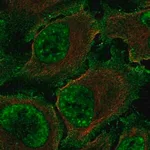 Merck Anti-TBXA2R antibody produced in rabbit