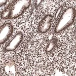 Merck Anti-SETD2 antibody produced in rabbit