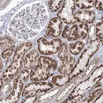 Merck Anti-METTL5 antibody produced in rabbit