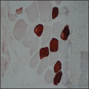 Merck Anti-Myosin (Skeletal, Slow) antibody, Mouse monoclonal