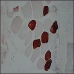 Merck Anti-Myosin (Skeletal, Slow) antibody, Mouse monoclonal