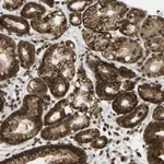 Merck Anti-GALNT1 antibody produced in rabbit