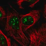Merck Anti-DKC1 antibody produced in rabbit