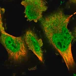 Merck Anti-DYRK2 antibody produced in rabbit