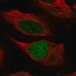 Merck Anti-KMT2C antibody produced in rabbit
