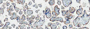 Merck Anti-EGFR Antibody