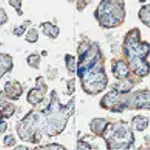 Merck Anti-EGFR Antibody