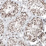 Merck Anti-KMT5C antibody produced in rabbit
