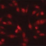 Merck Anti-Twist1 antibody produced in rabbit