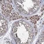 Merck Anti-METTL4 antibody produced in rabbit