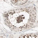 Merck Anti-KDM4A antibody produced in rabbit