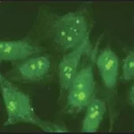 Merck Anti-Nucleolin antibody produced in rabbit