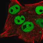 Merck Anti-ETV5 antibody produced in rabbit