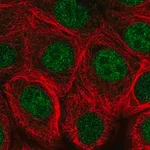 Merck Anti-MNX1 antibody produced in rabbit