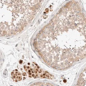 Merck Anti-SARM1 antibody produced in rabbit