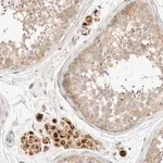 Merck Anti-SARM1 antibody produced in rabbit