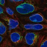 Merck Anti-RANBP2 antibody produced in rabbit