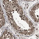 Merck Anti-RNF114 antibody produced in rabbit