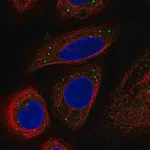 Merck Anti-BRAF antibody produced in rabbit