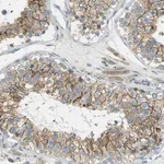 Merck Anti-RHBDD1 antibody produced in rabbit