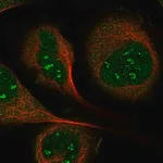 Merck Anti-IP6K1 antibody produced in rabbit