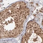 Merck Anti-HUWE1 antibody produced in rabbit