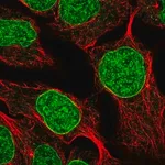 Merck Anti-DUSP2 antibody produced in rabbit