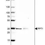 Merck Anti-PPT1 antibody produced in rabbit