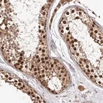 Merck Anti-RNF187 antibody produced in rabbit