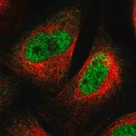 Merck Anti-SPRTN antibody produced in rabbit