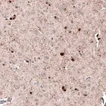 Merck Anti-ROBO2 antibody produced in rabbit