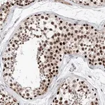 Merck Anti-SNRNP200 antibody produced in rabbit
