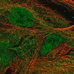 Merck Anti-MASP1 antibody produced in rabbit