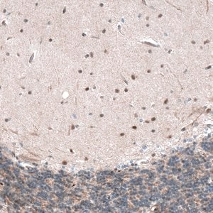 Merck Anti-CAMTA1 antibody produced in rabbit