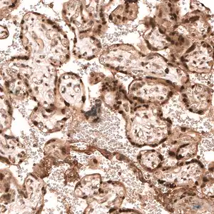 Merck Anti-PARP14 antibody produced in rabbit