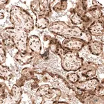 Merck Anti-PARP14 antibody produced in rabbit