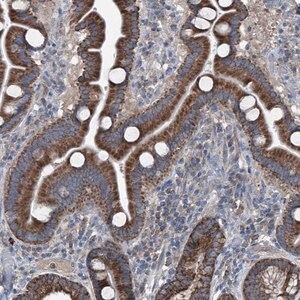 Merck Anti-GPAT3 antibody produced in rabbit
