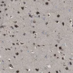Merck Anti-KANK2 antibody produced in rabbit
