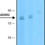Merck Anti-ADAR2 antibody, Mouse monoclonal