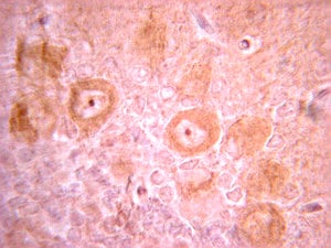 Merck Anti-PDGFR Antibody, clone CH-3