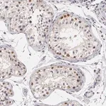 Merck Anti-ZBTB16 antibody produced in rabbit