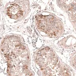Merck Anti-MTM1 antibody produced in rabbit