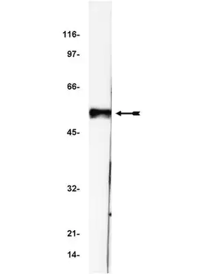 Merck Anti-p53 Antibody, clone BP53-12