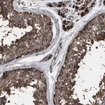 Merck Anti-VPS13A antibody produced in rabbit
