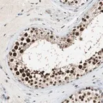 Merck Anti-SIRT1 antibody produced in rabbit